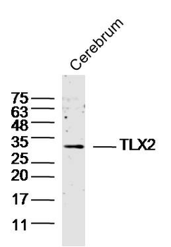 TLX2 Rabbit Polyclonal Antibody