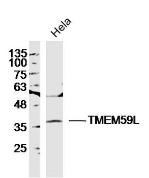 TMEM59L Rabbit Polyclonal Antibody