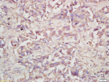 ATP6V0A1 Rabbit Polyclonal Antibody