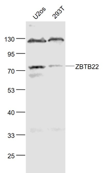 ZBTB22 Rabbit Polyclonal Antibody