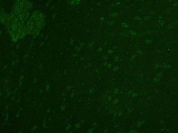 Zic1 Rabbit Polyclonal Antibody