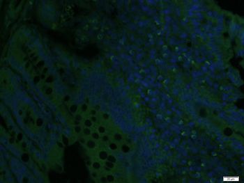 CD105 Rabbit Polyclonal Antibody (BF488)