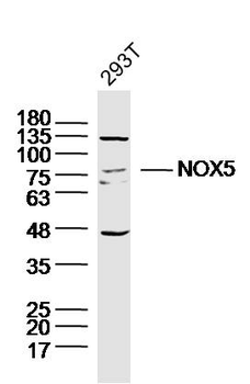 NOX5 Rabbit Polyclonal Antibody