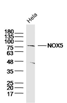 NOX5 Rabbit Polyclonal Antibody