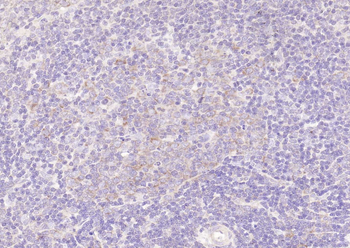 CD52 Rabbit Polyclonal Antibody
