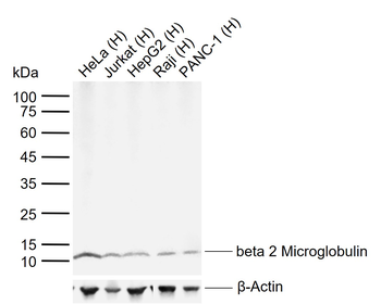 Beta 2 Microglobulin Mouse Monoclonal Antibody