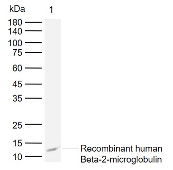 Beta 2 Microglobulin Mouse Monoclonal Antibody