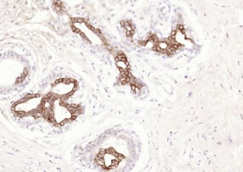Cytokeratin 15 Mouse Monoclonal Antibody