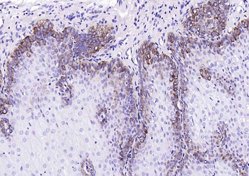 Cytokeratin 15 Mouse Monoclonal Antibody