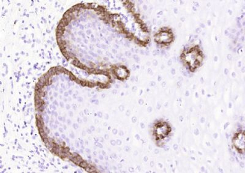 Cytokeratin 15 Mouse Monoclonal Antibody
