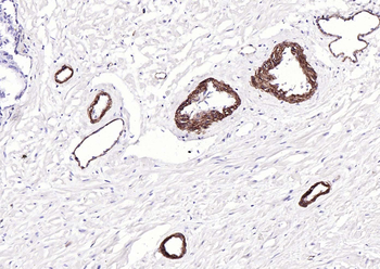CD239 Recombinant Rabbit Monoclonal Antibody