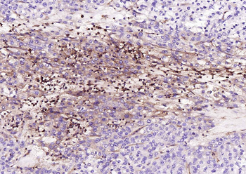 HLA-C Mouse Monoclonal Antibody