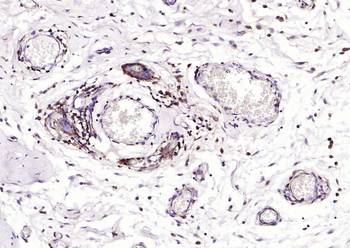 HLA-C Mouse Monoclonal Antibody