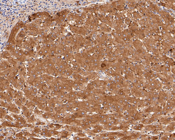 Ferritin Heavy Chain Recombinant Rabbit Monoclonal Antibody