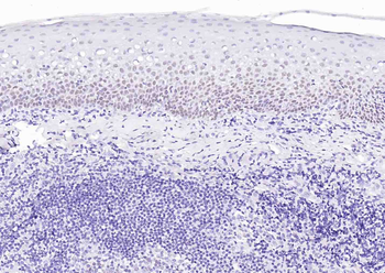 P63 Recombinant Rabbit Monoclonal Antibody