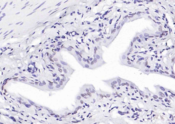 P63 Recombinant Rabbit Monoclonal Antibody
