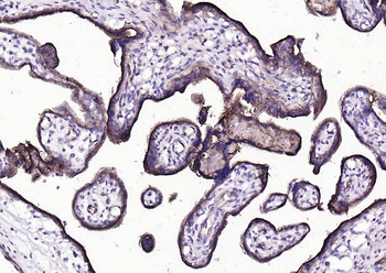 CD39/ENTPD1 Recombinant Rabbit Monoclonal Antibody