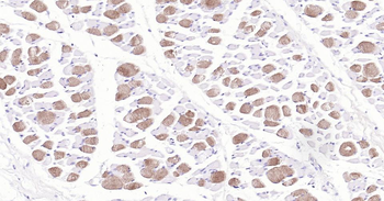 MYH6 Recombinant Rabbit Monoclonal Antibody