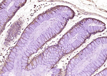 USP10 Rabbit Polyclonal Antibody