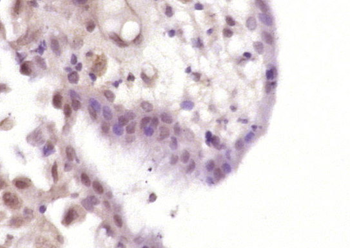 CDX2+3 Rabbit Polyclonal Antibody