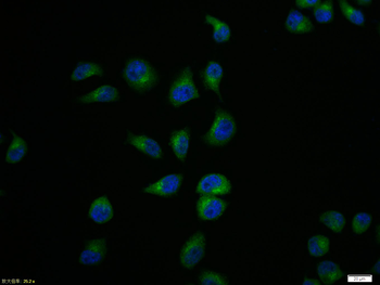 IRAK1 Rabbit Polyclonal Antibody