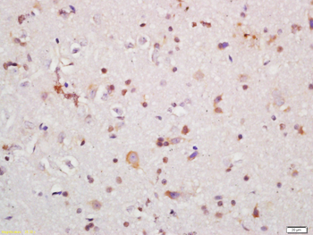 IRAK1 Rabbit Polyclonal Antibody