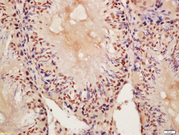 PROCA1 Rabbit Polyclonal Antibody
