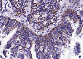 S100A10 Rabbit Polyclonal Antibody