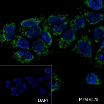 Heme Oxygenase 1 Recombinant Rabbit Monoclonal Antibody