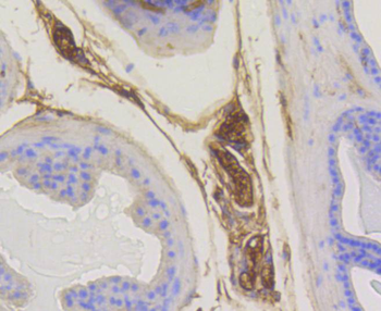 RAB5A Recombinant Rabbit Monoclonal Antibody