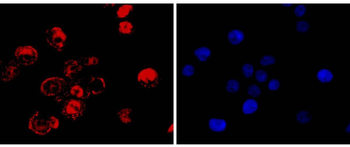 CDX2 Recombinant Rabbit Monoclonal Antibody
