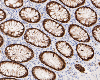 CDX2 Recombinant Rabbit Monoclonal Antibody