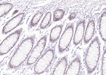 CDX2 Recombinant Rabbit Monoclonal Antibody
