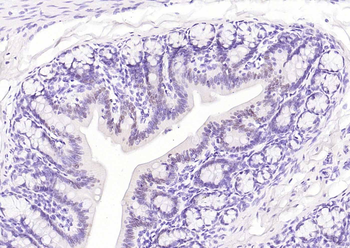 CDX2 Recombinant Rabbit Monoclonal Antibody
