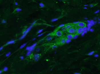 FGF18 Rabbit Polyclonal Antibody