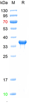 Recombinant human CYP4A11 protein, N-Trx-His