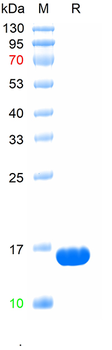 Recombinant human Cystatin-C protein (HEK293),C-His