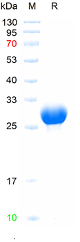 Recombinant mouse Angiopoietin 2 protein, N-His
