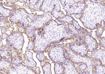 Placental alkaline phosphatase (PLAP) Mouse Monoclonal Antibody