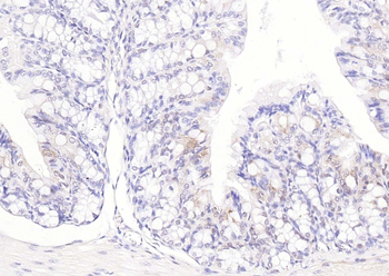 SOD1 Recombinant Rabbit Monoclonal Antibody