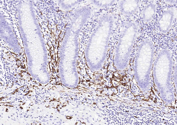 NCAM/CD56 Recombinant Mouse Monoclonal Antibody