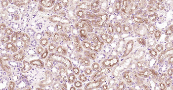 P Glycoprotein Recombinant Rabbit Monoclonal Antibody