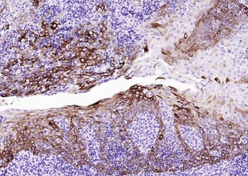 Keratin 14 Recombinant Rabbit Monoclonal Antibody