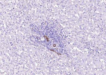 Caveolin-1 Recombinant Rabbit Monoclonal Antibody