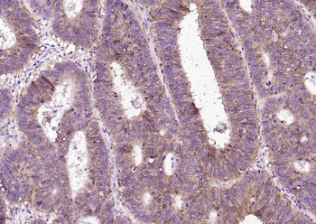 EpCAM Recombinant Rabbit Monoclonal Antibody