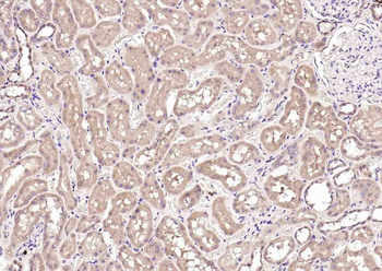 Renin Mouse Monoclonal Antibody