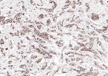 CTNND1 Mouse Monoclonal Antibody