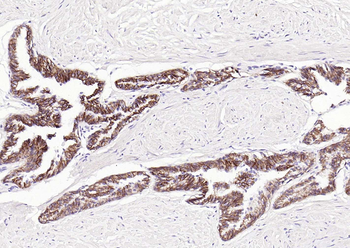 CTNND1 Mouse Monoclonal Antibody