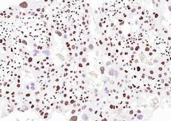 P57 Kip2 Mouse Monoclonal Antibody