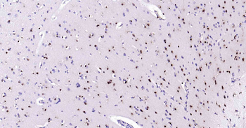 SOX2 Recombinant Rabbit Monoclonal Antibody